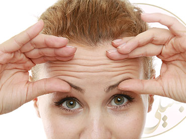 اصلاح خطوط اخم و پیشانی